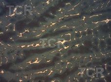 Metallography