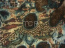 Metallography