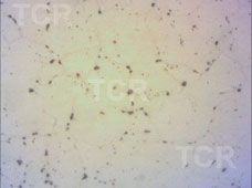 Metallography